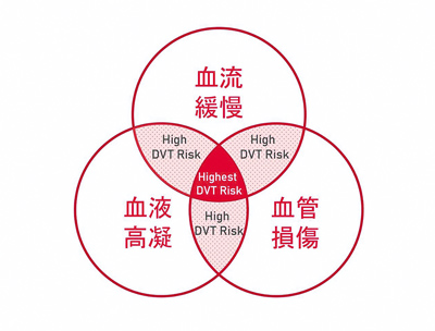 深層靜脈栓塞形成三要素。(國泰醫院提供) image