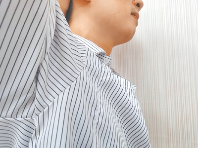 腋臭症俗稱「狐臭」,台灣約有10%人口受狐臭困擾,遺傳是主要影響因素,若雙親皆有狐臭,子女發生機率高達60%至80%。(王家瑜攝) image