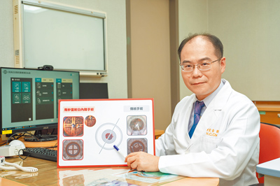 長庚引新術改善白內障併散光問題