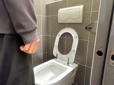 攝護腺現珊瑚礁腫塊竟是泌尿上皮癌無痛血尿別大意